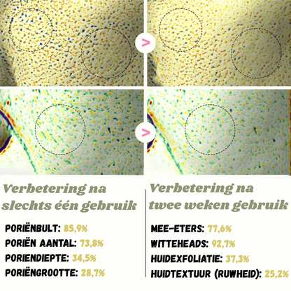 White & Black Rice Peel Shots – Verjongende Huidtransformatie