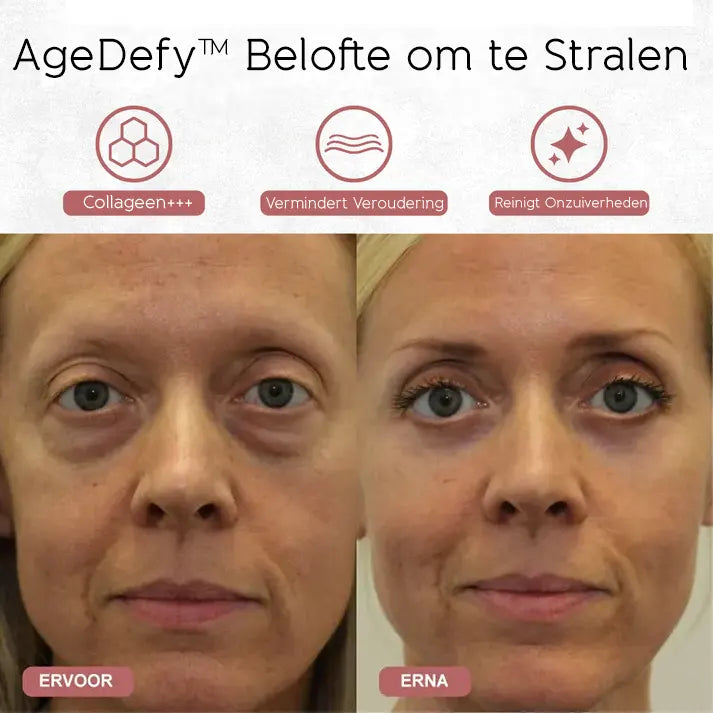 AgeDefy™ Trio Verjongende Hals- en Oogverzorgingsset met Red Light Therapie
